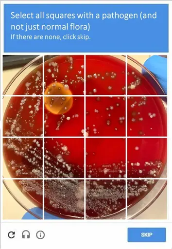 A CAPTCHA image shows a petri dish divided into 16 squares, with the prompt "Select all squares with a pathogen (and not just normal flora). If there are none, click skip." The petri dish contains a red growth medium with several distinct types of bacterial colonies. Some colonies are small, white, and circular, while others appear larger, irregularly shaped, and have a more grayish or fuzzy texture. In the center, there is a large yellow-orange blob. The bottom of the image shows three icons for refresh, audio, and information, along with a "SKIP" button.